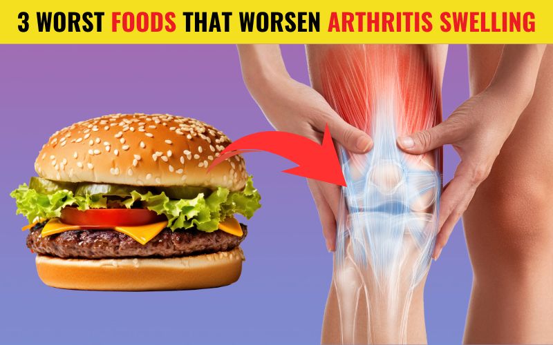 Top 3 Worst Foods That Worsen Arthritis Swelling 